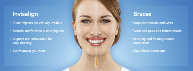 braces braces